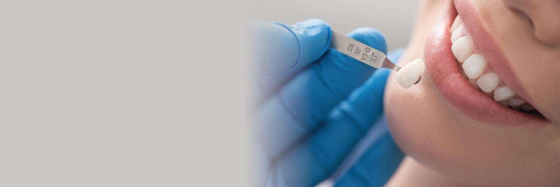 dental patient receiving dentist exam | dental bridges grand rapids mi